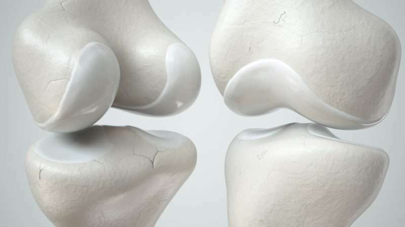 Trifocus fitness academy - types of cartilage