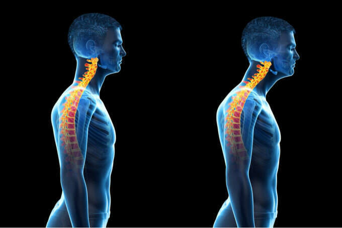 Trifocus Fitness Academy - forward head posture