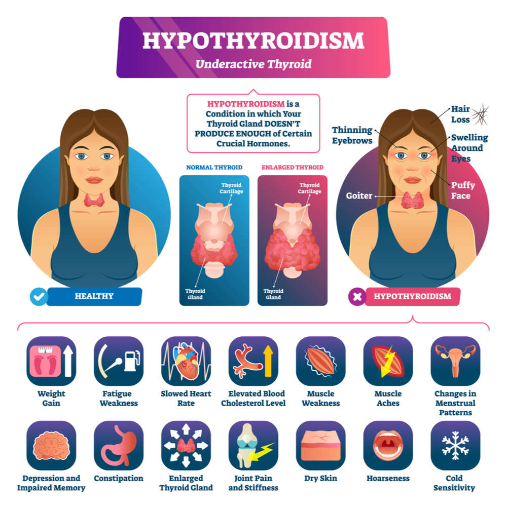 Trifocus Fitness Academy - thyroid imbalances